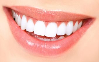 Bielenie zubov - Bielenie zubov za pomoci gélu a lampy s modrým svetlom, ktoré aktivuje účinok gélu.