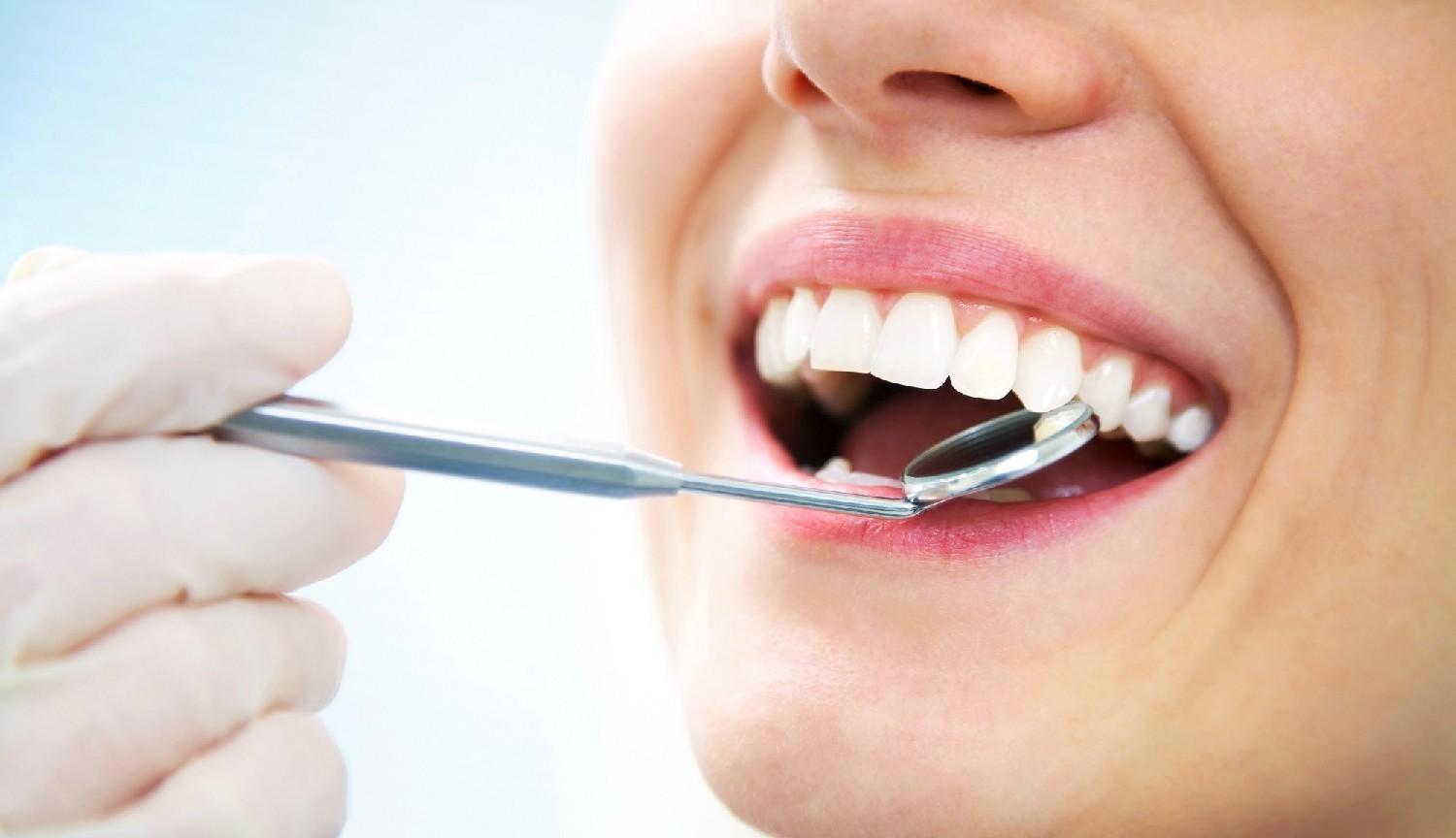 Kompletná dentálna hygiena - Vyčistenie zubného kameňa+pieskovanie+fluoridácia+nácvik správnej techniky čistenia+výber zubnej pomôcky